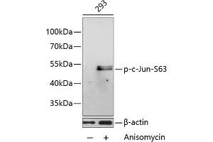 Western blot analysis of extracts of 293 cells, using Phospho-c-Jun-S63 antibody (ABIN3023570, ABIN3023571, ABIN3023572 and ABIN6225413) at 1:1000 dilution. (C-JUN 抗体  (pSer63))