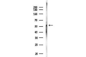 Western blot analysis of lysates from MDA-MB-231 cells, using Phospho-p53 (Ser392) Antibody at 1/1000 dilution.