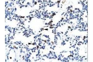 Image no. 1 for anti-E2F Transcription Factor 6 (E2F6) (AA 43-92) antibody (ABIN6735865) (E2F6 抗体  (AA 43-92))