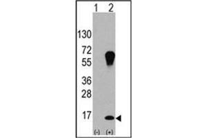 Western blot analysis of LC3 (APG8a) (arrow) using LC3 Antibody . (MAP1LC3A 抗体)