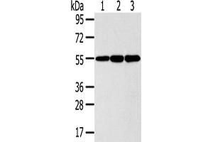 Gel: 8 % SDS-PAGE,Lysate: 40 μg,Lane 1-3: 293T cells, LO2 cells, Lovo cells,Primary antibody: ABIN7191125(ISM2 Antibody) at dilution 1/300 dilution,Secondary antibody: Goat anti rabbit IgG at 1/8000 dilution,Exposure time: 5 seconds (Isthmin 2 抗体)