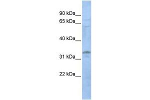 WB Suggested Anti-LYL1  Antibody Titration: 0. (LYL1 抗体  (N-Term))