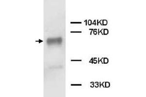 Western Blot analysis of PTPN11 expression from Jurkat cell lyate with PTPN11 polyclonal antibody .