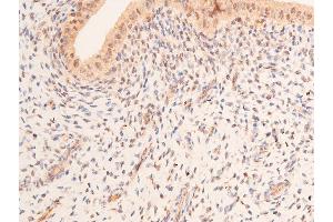 ABIN6267066 at 1/200 staining rat uterine tissue sections by IHC-P. (p53 抗体  (acLys319))