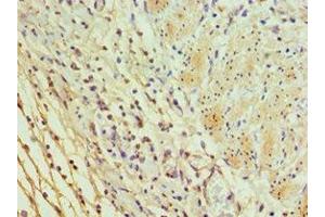 Immunohistochemistry of paraffin-embedded human epityphlon tissue using ABIN7156037 at dilution of 1:100 (ICOSLG 抗体  (AA 19-256))