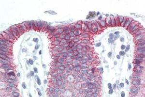 Human Colon (formalin-fixed, paraffin-embedded) stained with CTNNB1 antibody ABIN364501 at 10 ug/ml followed by biotinylated anti-mouse IgG secondary antibody ABIN481714, alkaline phosphatase-streptavidin and chromogen. (CTNNB1 抗体  (C-Term))