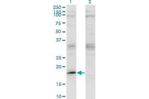 Western Blot analysis of LMO2 expression in transfected 293T cell line by LMO2 monoclonal antibody (M07), clone 4E2. (LMO2 抗体  (AA 16-102))