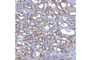 IHC analysis of TRMT61A using anti-TRMT61A antibody (ABIN7599220).