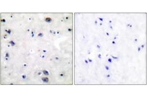 Immunohistochemistry (IHC) image for anti-Opioid Receptor, mu 1 (OPRM1) (AA 341-390) antibody (ABIN2888574) (Mu Opioid Receptor 1 抗体  (AA 341-390))