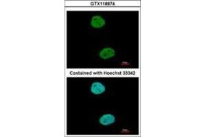 Image no. 3 for anti-General Transcription Factor IIIC, Polypeptide 4 (GTF3C4) (AA 73-334) antibody (ABIN1498564) (GTF3C4 抗体  (AA 73-334))