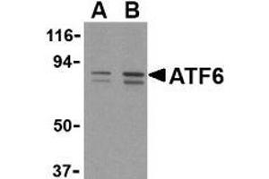 Western blot analysis of ATF6 in MCF7 cell lysate with this product atF6 antibody at (A) 0.