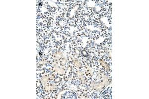 Immunohistochemical staining (Formalin-fixed paraffin-embedded sections) of human lung (A) and human kidney (B) with AKAP8L polyclonal antibody  at 4-8 ug/mL working concentration. (AKAP8L 抗体  (C-Term))