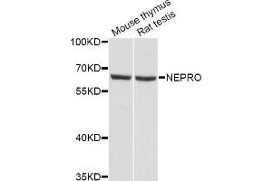 Western blot analysis of extracts of various cell lines, using NEPRO Antibody (ABIN5998324) at 1/1000 dilution. (NEPRO 抗体)
