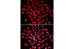 Immunofluorescence analysis of U2OS cells using CAMK4 antibody (ABIN5973050). (CAMK4 抗体)