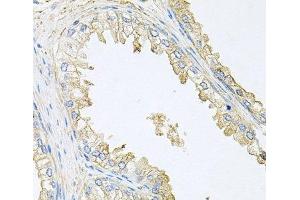 Immunohistochemistry of paraffin-embedded Human prostate using PPP3R1 Polyclonal Antibody at dilution of 1:100 (40x lens). (PPP3R1 抗体)