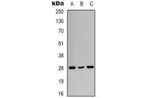 Western blot analysis of 14-3-3 zeta (pT232) expression in A431 UV-treated (A), K562 UV-treated (B), NIH3T3 UV-treated (C) whole cell lysates. (14-3-3 zeta 抗体  (C-Term, pThr232))
