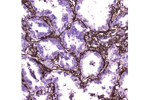 IHC analysis of Annexin VI using anti-Annexin VI antibody . (ANXA6 抗体  (AA 395-665))