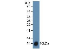 Detection of TFF3 in Rat Uterus Tissue using Polyclonal Antibody to Trefoil Factor 3 (TFF3) (TFF3 抗体  (AA 23-81))