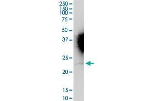 IFNA16 MaxPab rabbit polyclonal antibody. (IFNA16 抗体  (AA 1-189))