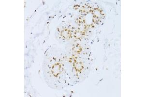Immunohistochemistry of paraffin-embedded human breast using ZEB2 antibody (ABIN5973336) at dilution of 1/100 (40x lens). (ZEB2 抗体)