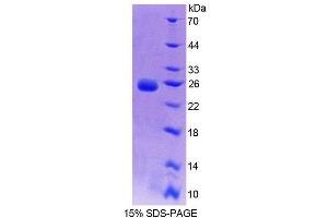 SDS-PAGE analysis of Rat BCAT2 Protein. (BCAT2 蛋白)
