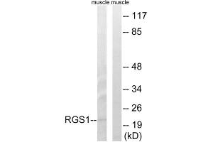 Western blot analysis of extracts from mouse muscle cells, using RGS1 antibody. (RGS1 抗体  (Internal Region))