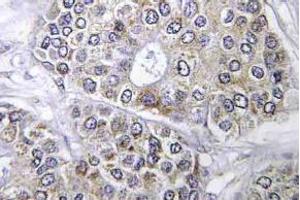 Immunohistochemistry (IHC) analyzes of Bcl-2 antibody in paraffin-embedded human brain tissue. (Bcl-2 抗体)