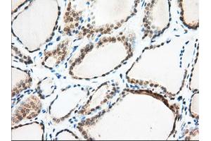 Immunohistochemical staining of paraffin-embedded Human Kidney tissue using anti-MIOX mouse monoclonal antibody. (MIOX 抗体)