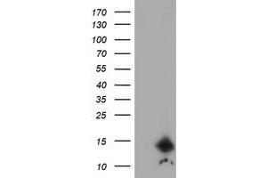 Image no. 1 for anti-Cystatin C (CST3) antibody (ABIN1497753) (CST3 抗体)