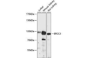 Western blot analysis of extracts of various cell lines, using ERCC3 antibody (ABIN6127770, ABIN6140267, ABIN6140268 and ABIN6216436) at 1:3000 dilution. (ERCC3 抗体  (AA 512-782))