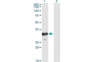 Western Blot analysis of MYOZ2 expression in transfected 293T cell line by MYOZ2 monoclonal antibody (M02), clone 1D4. (MYOZ2 抗体  (AA 1-264))