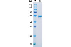 SDS-PAGE (SDS) image for Carbonic Anhydrase IX (CA9) (AA 38-414) protein (His tag) (ABIN6964087)
