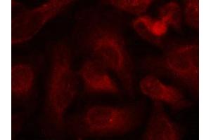 Immunofluorescence staining of methanol-fixed Hela cells using ABL1/2(phospho-Tyr393/439) Antibody.