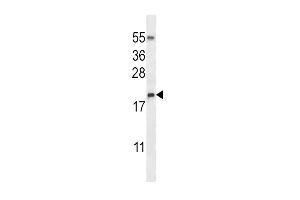 Western blot analysis in NCI-H460 cell line lysates (35ug/lane). (RNASE3 抗体  (C-Term))
