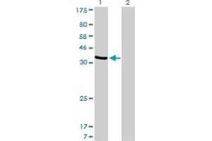 Western Blot analysis of AKR1D1 expression in transfected 293T cell line by AKR1D1 monoclonal antibody (M03), clone 1C2. (AKR1D1 抗体  (AA 227-326))