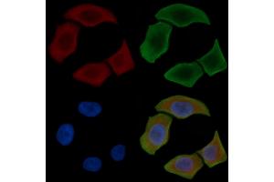 ABIN6263599 and ABIN6277934 staining Hela cells(30 min of UV treatment) by IF/ICC. (Nestin 抗体  (C-Term))