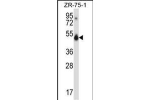 CUGBP1 Antibody (N-term) (ABIN657957 and ABIN2846902) western blot analysis in ZR-75-1 cell line lysates (35 μg/lane). (CELF1 抗体  (N-Term))