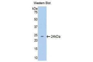 Western Blotting (WB) image for anti-Crystallin, beta B2 (CRYbB2) (AA 17-191) antibody (ABIN1077954) (CRYbB2 抗体  (AA 17-191))