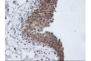 Image no. 3 for anti-V-Ets Erythroblastosis Virus E26 Oncogene Homolog 2 (ETS2) (AA 90-349) antibody (ABIN1491702)