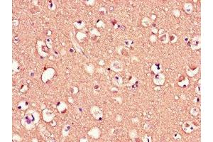 Immunohistochemistry of paraffin-embedded human brain tissue using ABIN7159104 at dilution of 1:100 (MED12 抗体  (AA 1742-2011))