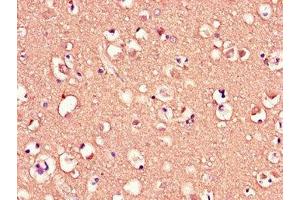 Immunohistochemistry of paraffin-embedded human brain tissue using ABIN7159104 at dilution of 1:100 (MED12 抗体  (AA 1742-2011))