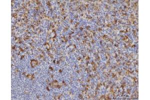 IHC analysis of ME1 using anti-ME1 antibody (ABIN7599485).