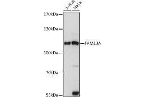 Western blot analysis of extracts of various cell lines, using FA antibody (ABIN7267109) at 1:1000 dilution. (FAM13A 抗体  (AA 1-200))