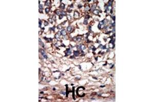 Immunohistochemistry (Paraffin-embedded Sections) (IHC (p)) image for anti-NIMA (Never in Mitosis Gene A)- Related Kinase 9 (NEK9) (AA 846-877), (C-Term) antibody (ABIN392654)