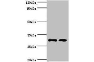 Western blot All lanes: RPA4 antibody at 3 μg/mL Lane 1: K562 whole cell lysate Lane 2: Mouse spleen tissue Secondary Goat polyclonal to rabbit IgG at 1/10000 dilution Predicted band size: 29 kDa Observed band size: 29 kDa (RPA4 抗体  (AA 1-230))