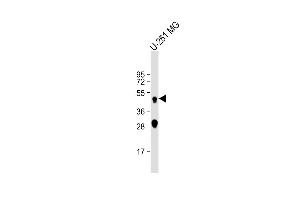 Anti-CTSD Antibody at 1:2000 dilution + U-251 MG whole cell lysate Lysates/proteins at 20 μg per lane. (Cathepsin D 抗体)
