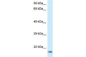 WB Suggested Anti-RPL23A Antibody Titration: 1. (RPL23A 抗体  (C-Term))