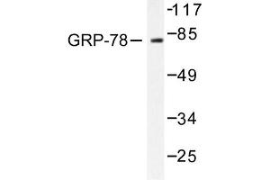 Image no. 1 for anti-Heat Shock 70kDa Protein 5 (Glucose-Regulated Protein, 78kDa) (HSPA5) antibody (ABIN265447) (GRP78 抗体)