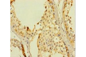 Immunohistochemistry of paraffin-embedded human testis tissue using ABIN7168079 at dilution of 1:100 (RHOXF2 抗体  (AA 1-244))