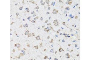 Immunohistochemistry of paraffin-embedded Mouse brain using USP25 Polyclonal Antibody at dilution of 1:100 (40x lens). (USP25 抗体)